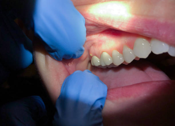 Best Holiday Emergency Dentist in Shippensburg University, PA